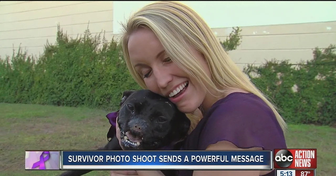 Two Incredible Survivors, One Human, One Dog, Share This Beautiful Bond!