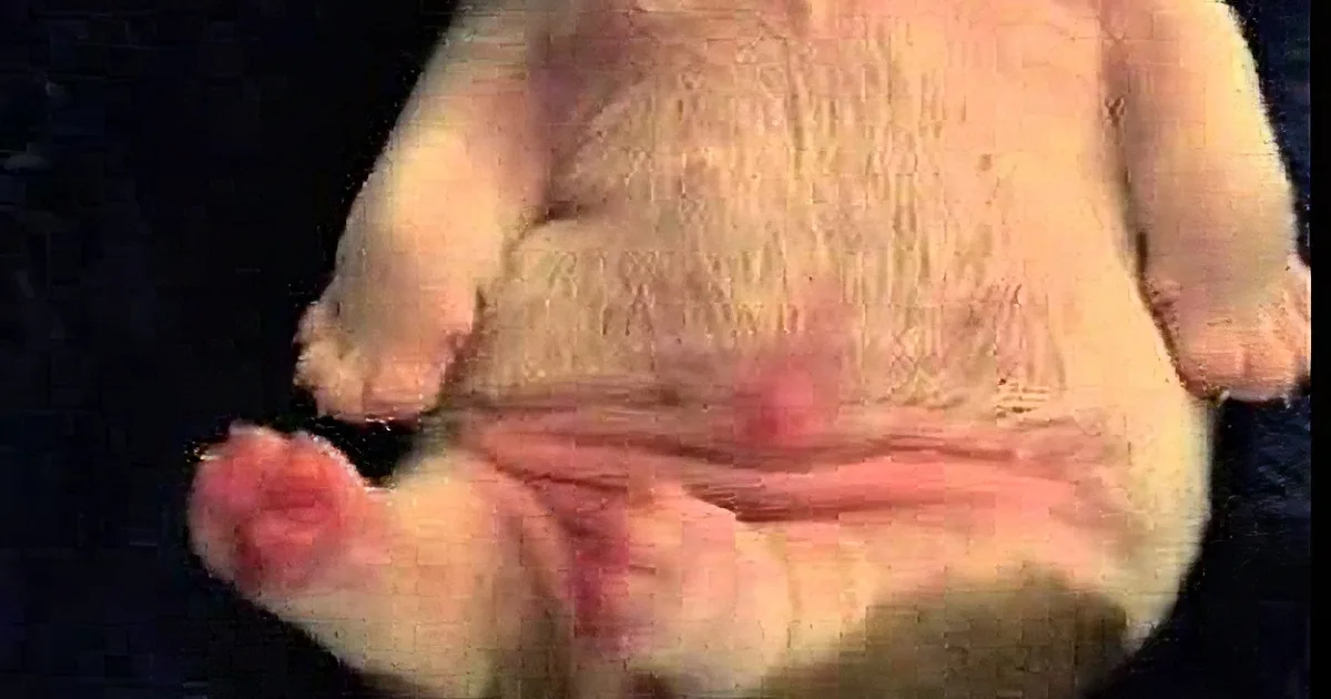 A close-up of a dog's belly with visible nipples and a pinkish hue.