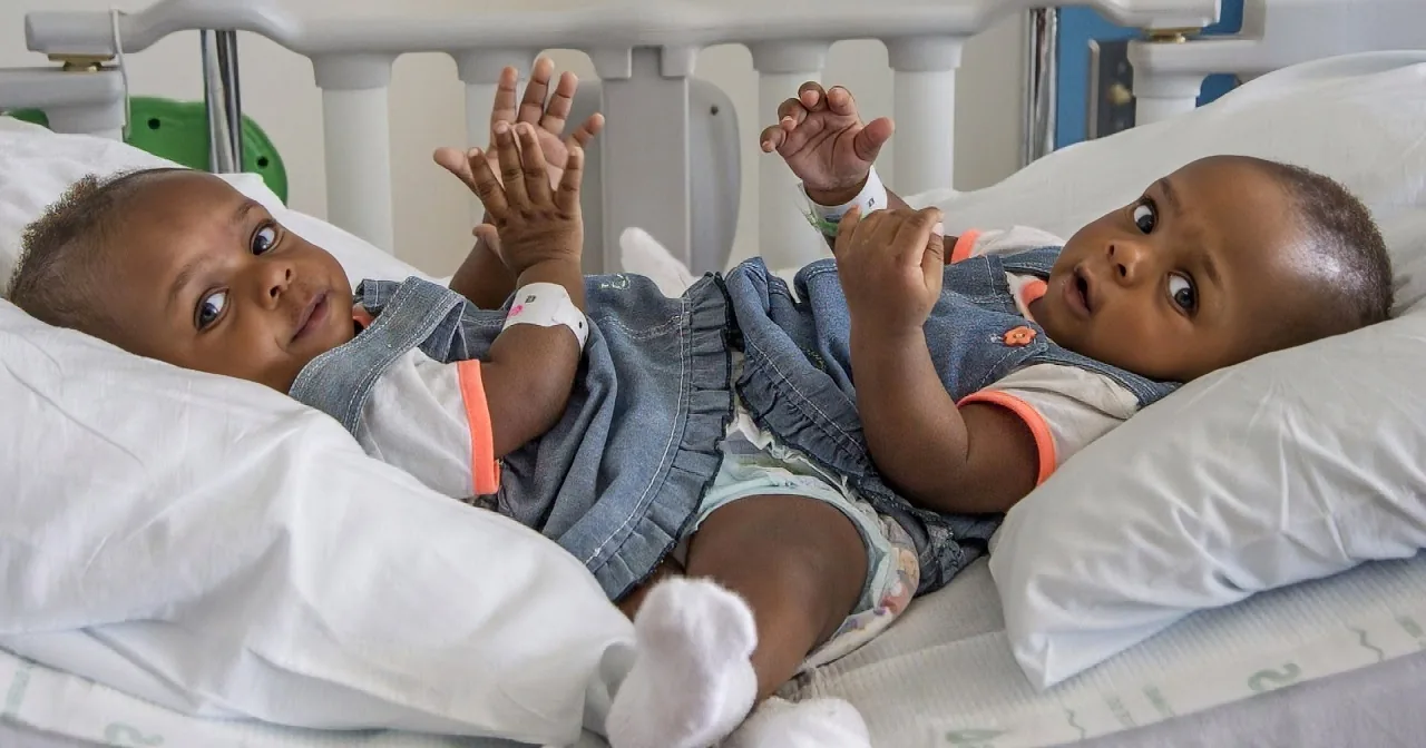 Twin Girls Get Life Changing Surgery on Their First Birthday! the Reason Will Break Your Heart.