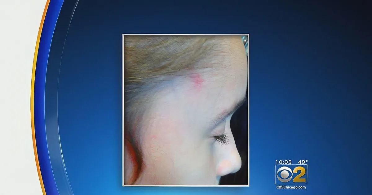 Eight-Year-Old Girl Is on News Channel for Being Bullied. What She Said Next Made Me Sad.