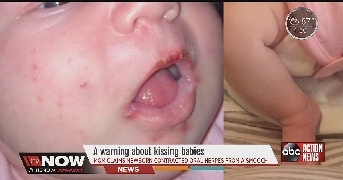 An Acquaintance Kisses a Baby on the Mouth. What Happened Later Shocked Me.
