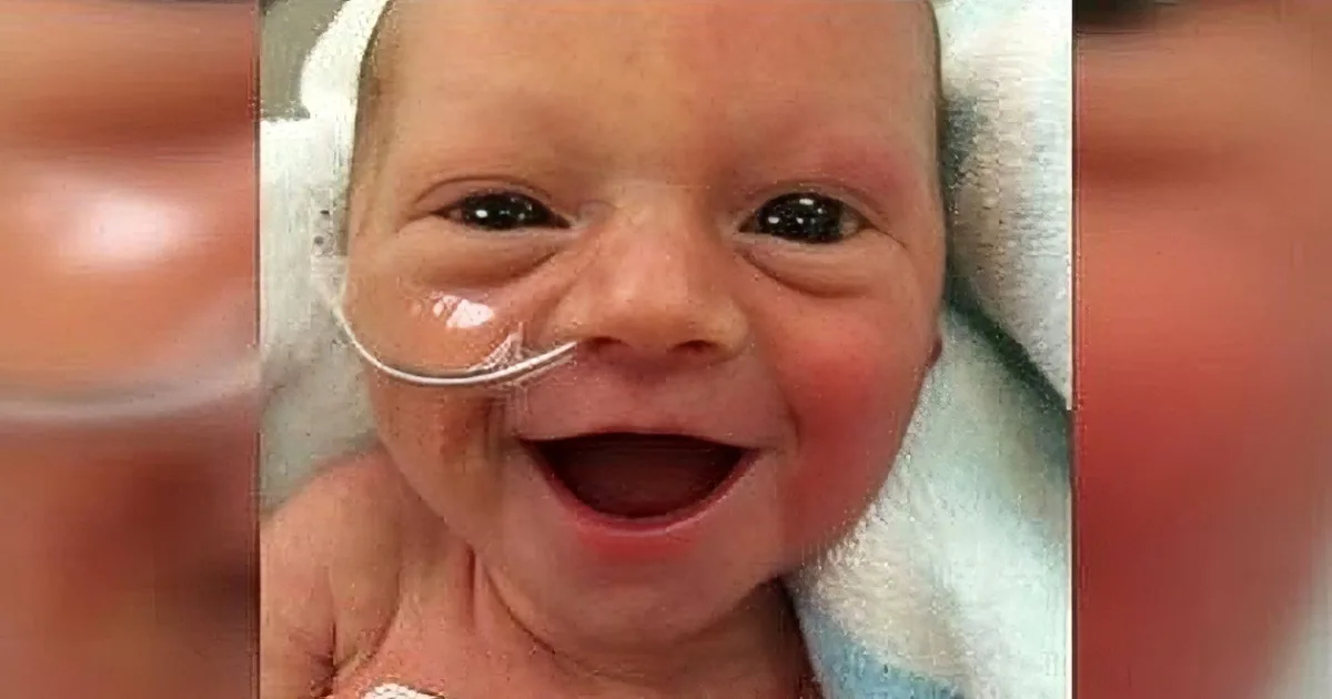 A newborn baby smiles widely, wearing a hospital cap and connected to an oxygen tube.