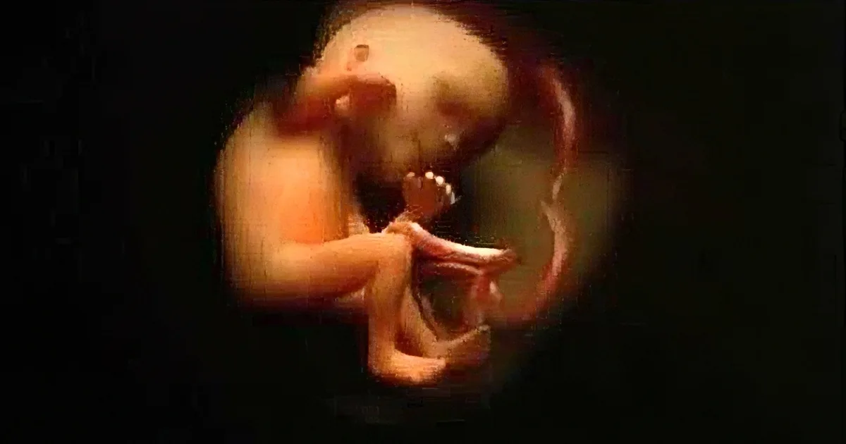 A fetus is curled up in a fetal position, with its head tilted to the side and arms bent.