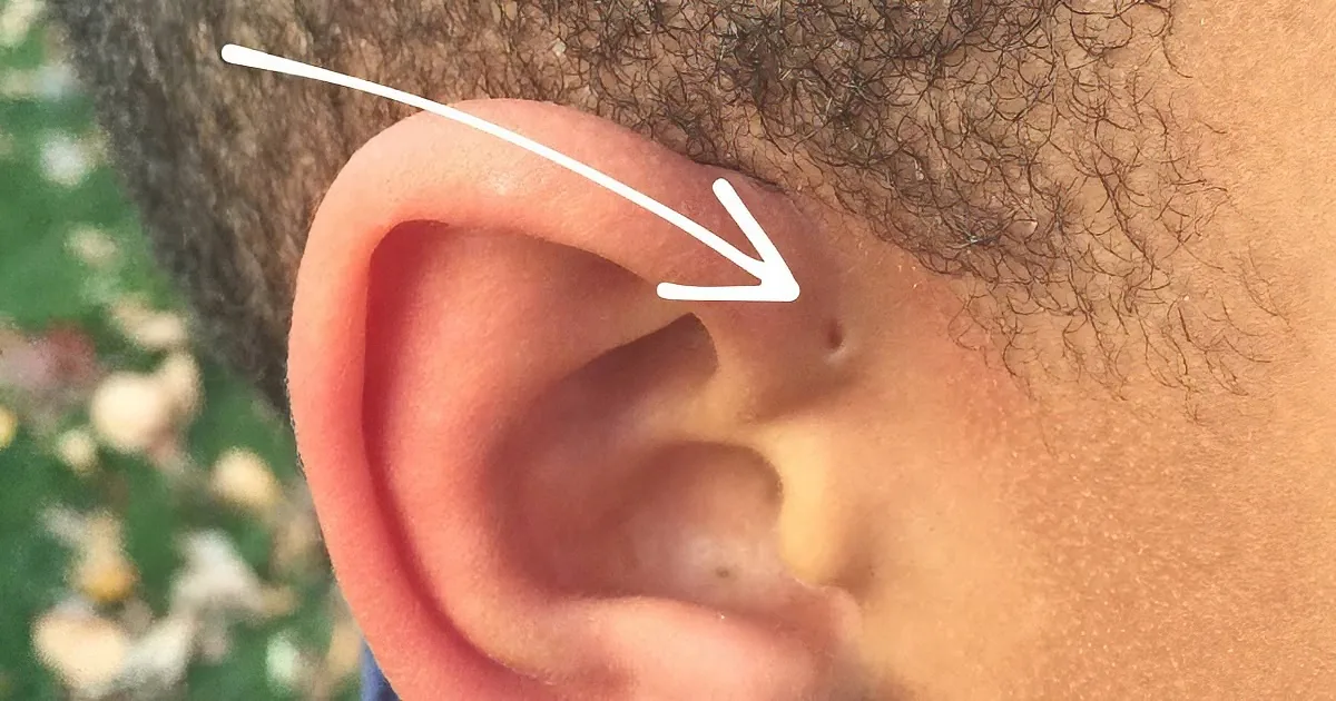 Have You Ever Noticed a Tiny Hole Above Someone''s Ear? This Is the Strange Reason It''s There.