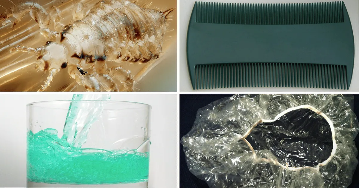 A close-up of a louse, a comb, a glass with splashing liquid, and a plastic bag with a hole.
