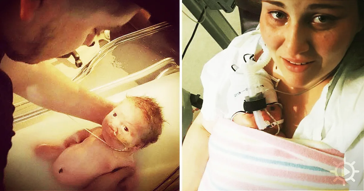 A newborn baby is held by a parent in a hospital setting, connected to medical equipment.