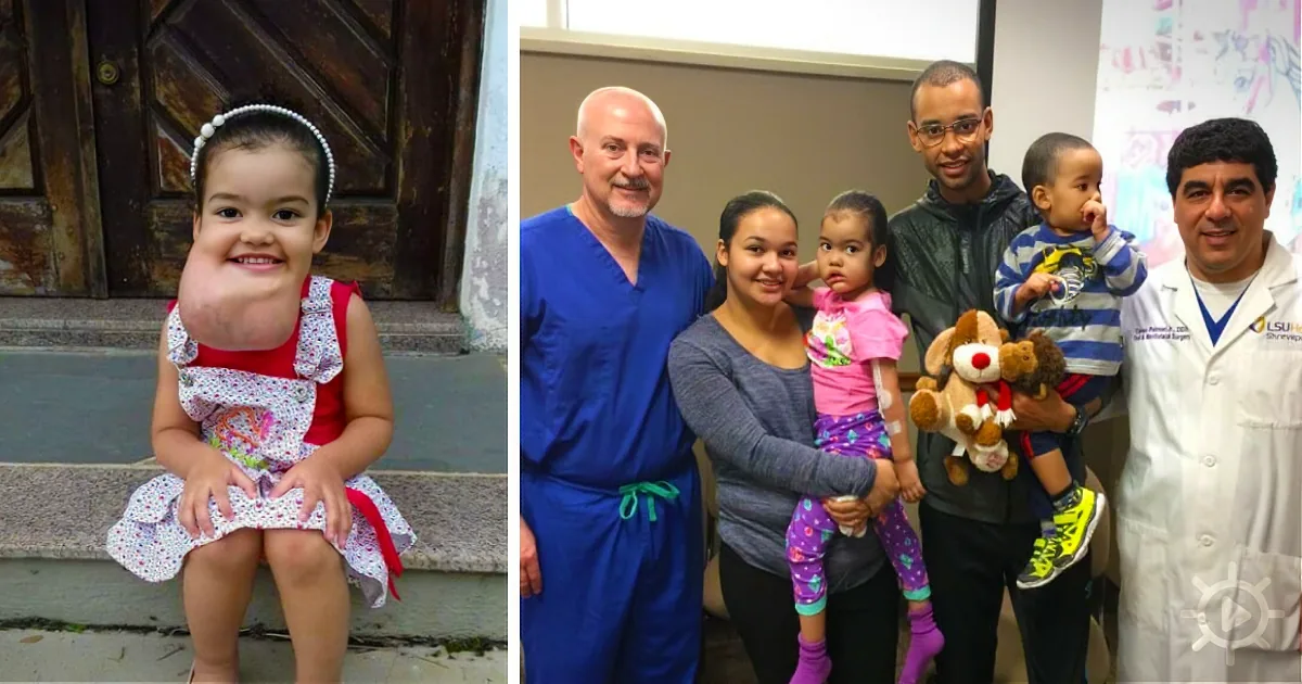A young girl with a large, round face sits on steps, smiling, while a family and medical professionals pose for a photo.