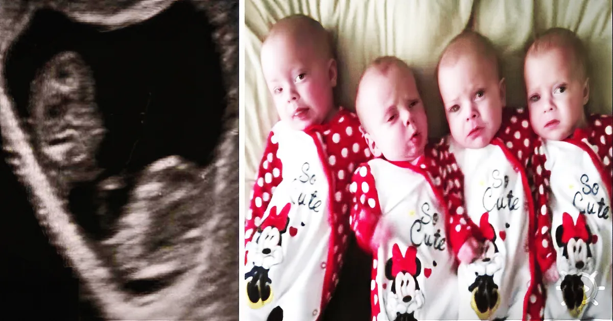 An ultrasound of a fetus and four babies in matching outfits.