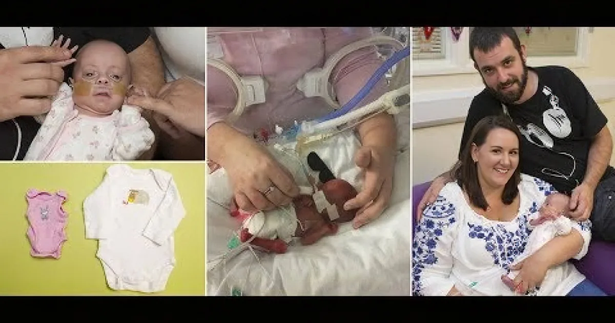 Tiny Preemie Defies the Odds and Survives! This Is Amazing! OMG!
