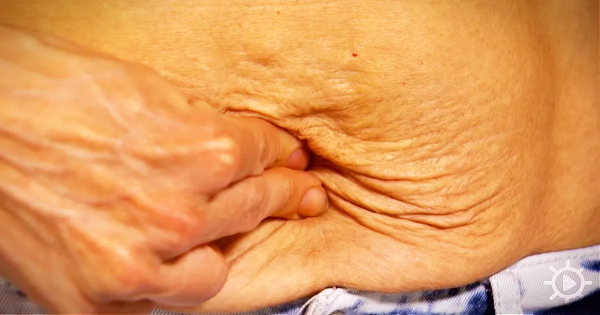 A Mom Gives Birth Twice in 15 Months. Then, a Strange Hole Appears in Her Stomach!