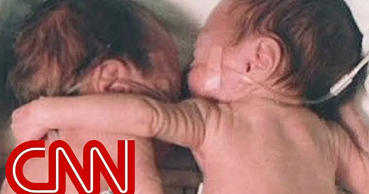 A newborn baby is being held and comforted by an adult, both appearing distressed.