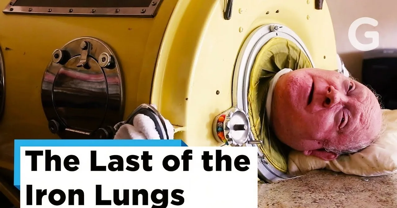Discover How This MacHine Helps Paul Alexander to Live Since 1952.