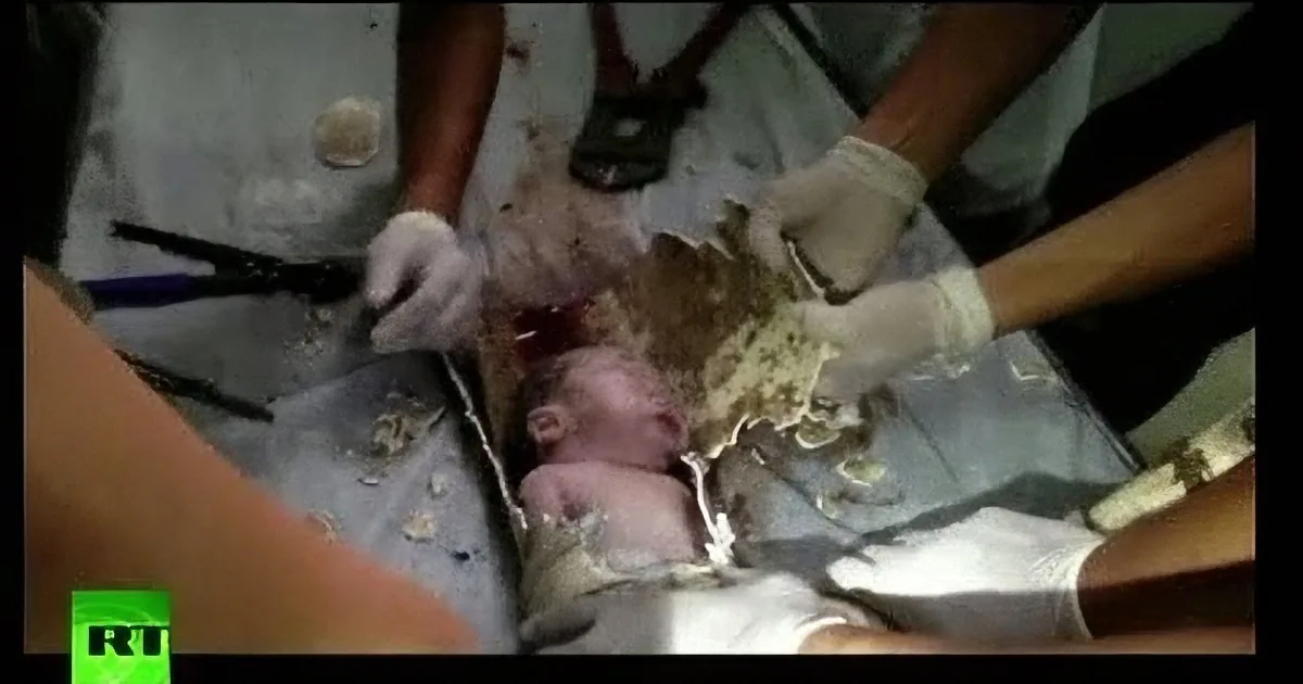 A newborn baby is being cleaned by medical professionals in a clinical setting.