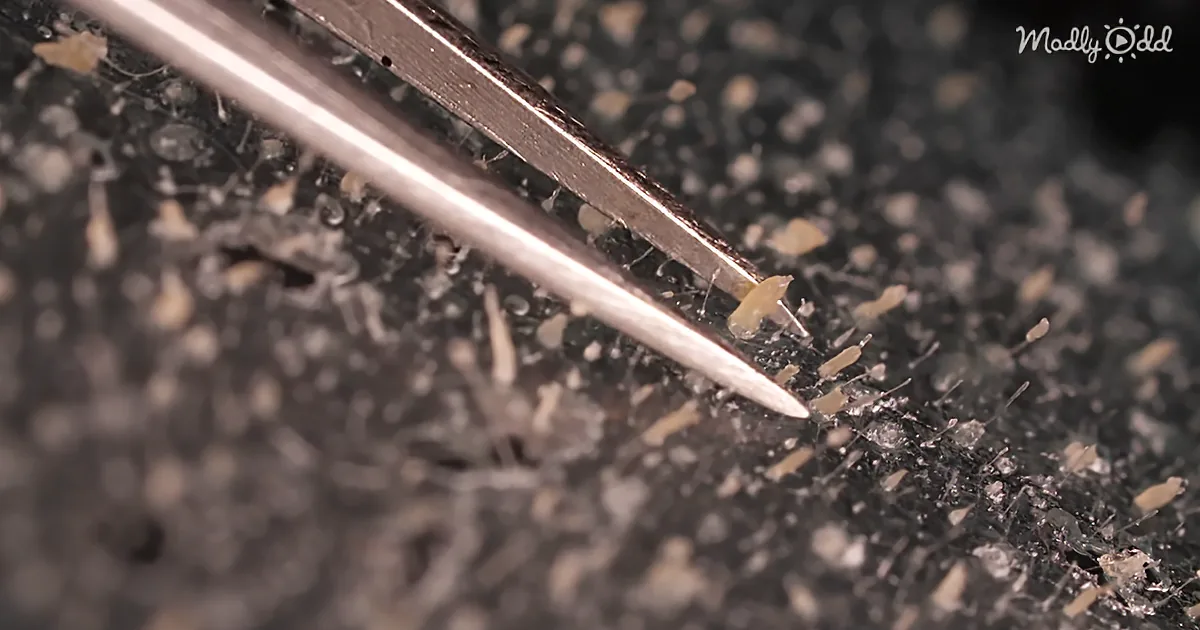 ''''Face Mites'' Live in Your Pores and Mate on Your Face While You Sleep''