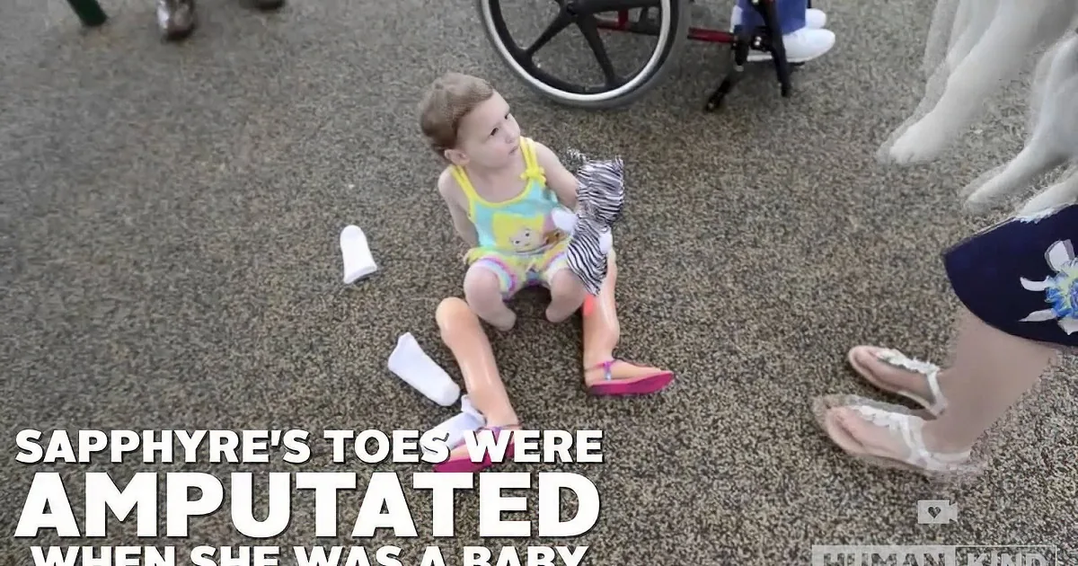 Toddler Born Without Feet Gets a Puppy Born Without a Paw: 'That's My Puppy, He's Just Like Me'