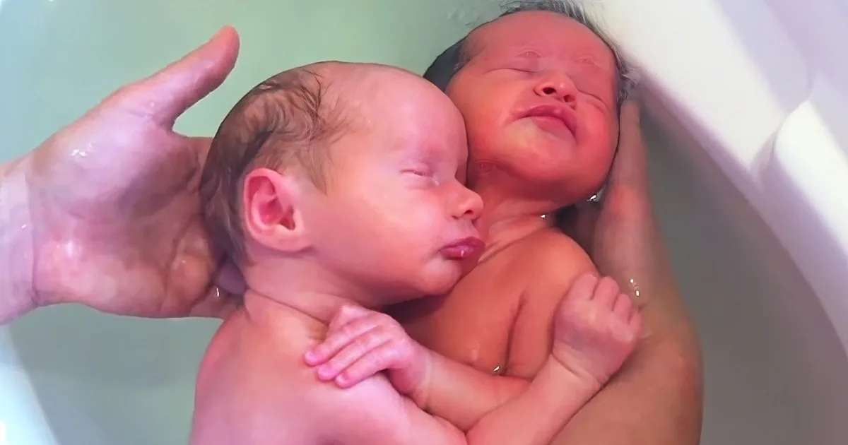 Newborn Twins Embrace Each Other as They Used to Inside the Womb