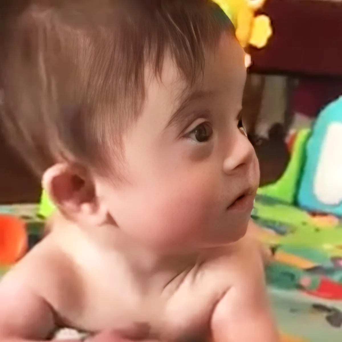 Baby with down syndrome