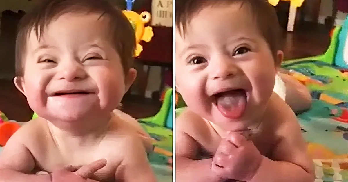 Baby With Down Syndrome Melts Hearts With Adorable Smile