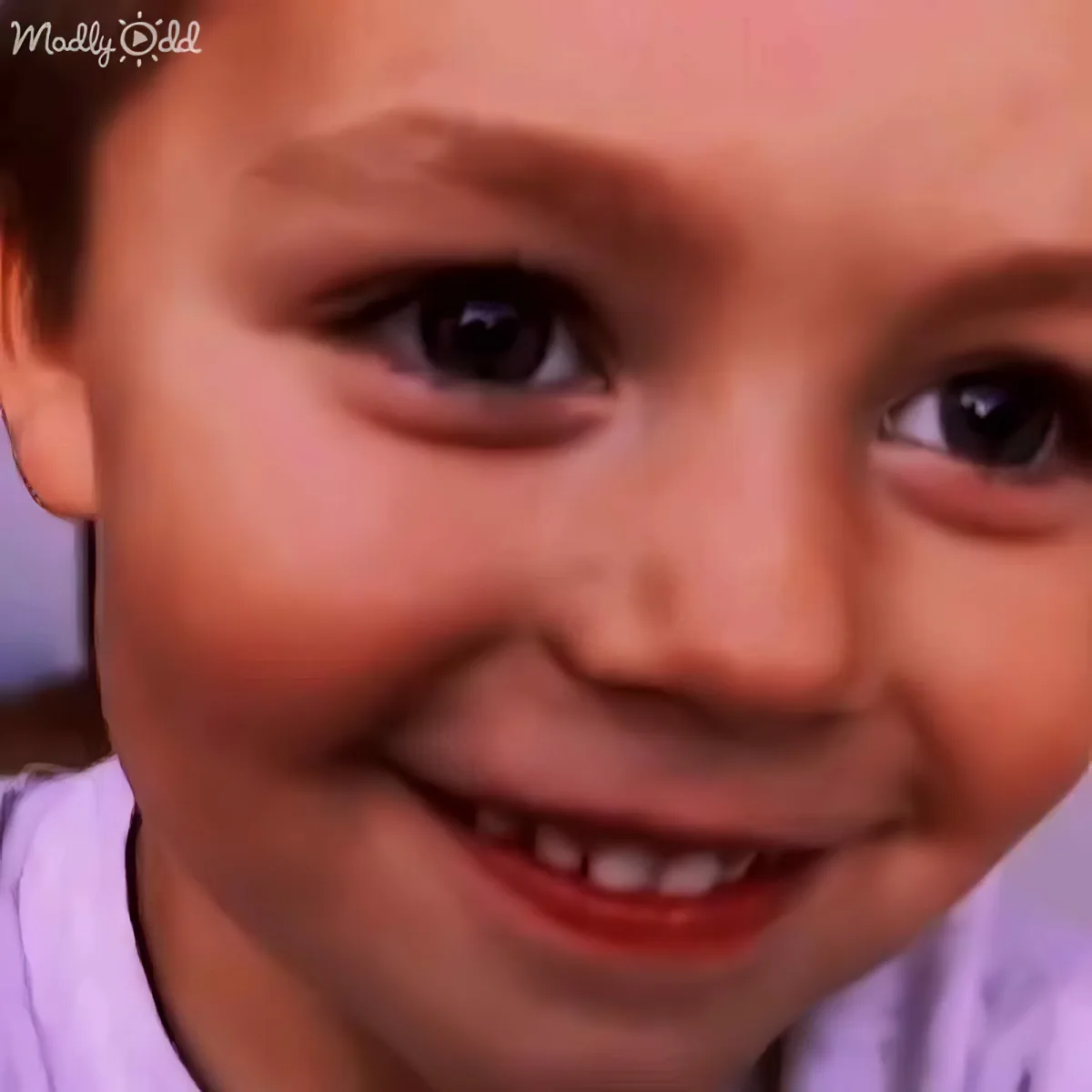 A smiling child with a small mole on the nose, wearing a light purple shirt.